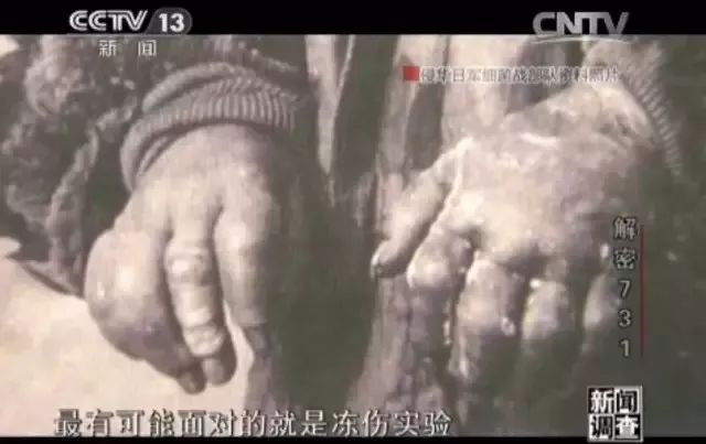 惨绝人寰日本电视台再次自揭731部队罪行