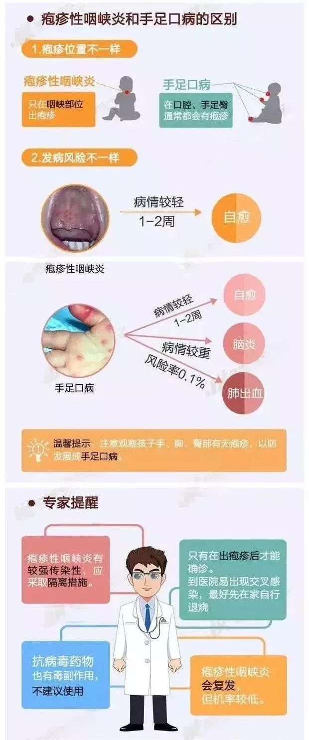 妈妈当心疱疹性咽峡炎高发每3个看病孩子中就有1个是这种病