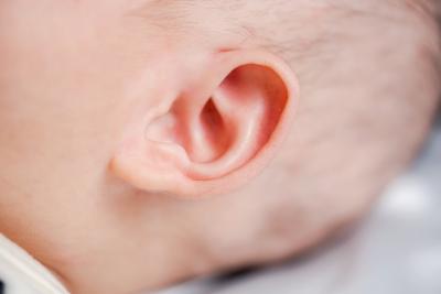 南医大顺德医院多学科专家联合会诊，为新生儿矫治耳廓畸形
